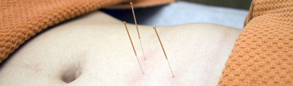 Accupuncture, Eastern Healing Arts in the Bristol, Bucks County PA area